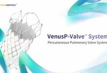 VenusP ValveTM receives CE marking under MDR and debuts in Europe